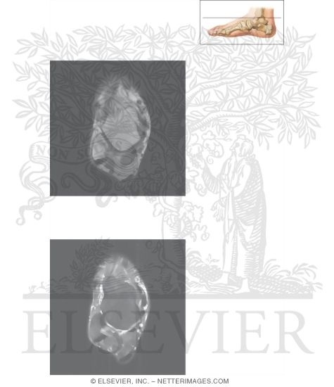 Watermarked preview of unlabeled image: Cross Section of the Ankle and Foot: Axial View