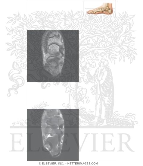 Watermarked preview of unlabeled image: Cross Section of the Ankle and Foot: Axial View