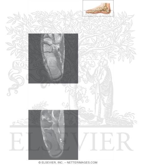 Watermarked preview of unlabeled image: Cross Section of the Ankle and Foot: Axial View