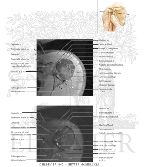 Watermarked preview of labeled image: Cross Section of the Shoulder: Axial View