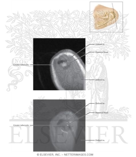 Watermarked preview of labeled image: Cross Section of the Shoulder: Sagittal Section