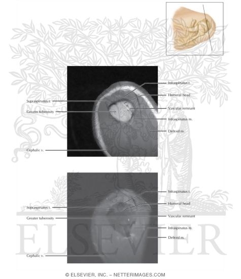 Watermarked preview of labeled image: Cross Section of the Shoulder: Sagittal Section