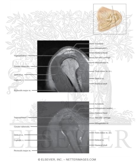 Watermarked preview of labeled image: Cross Section of the Shoulder: Sagittal Section