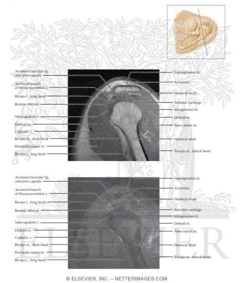 Cross Section of the Shoulder: Sagittal View