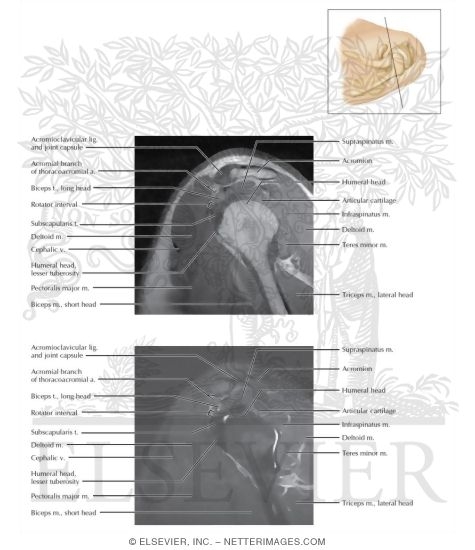 Watermarked preview of labeled image: Cross Section of the Shoulder: Sagittal View