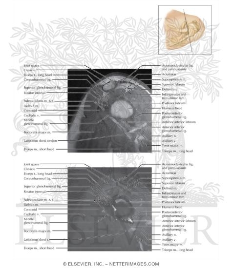 Cross Section of the Shoulder: Sagittal View