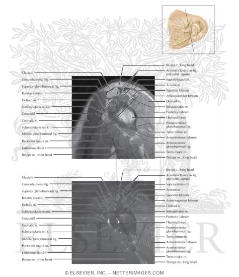 Cross Section of the Shoulder: Sagittal View
