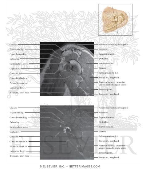 Cross Section of the Shoulder: Sagittal View