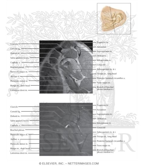 Watermarked preview of labeled image: Cross Section of the Shoulder: Sagittal View