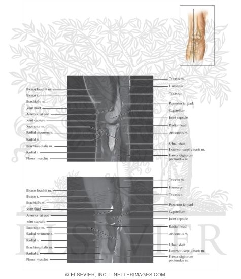 Watermarked preview of labeled image: Cross Section of the Elbow: Sagittal View