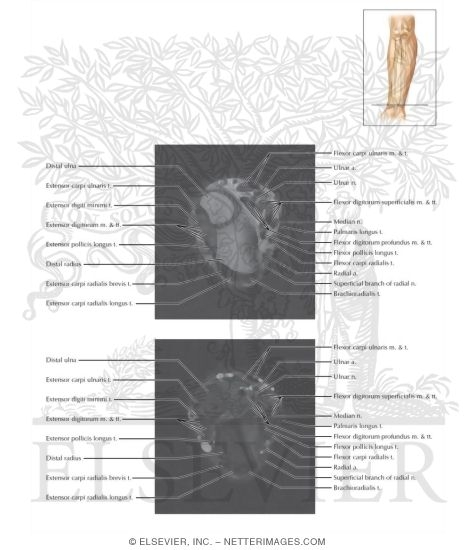 Cross Section of the Forearm: Axial View