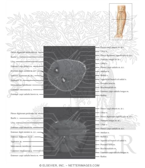 Watermarked preview of labeled image: Cross Section of the Forearm: Axial View