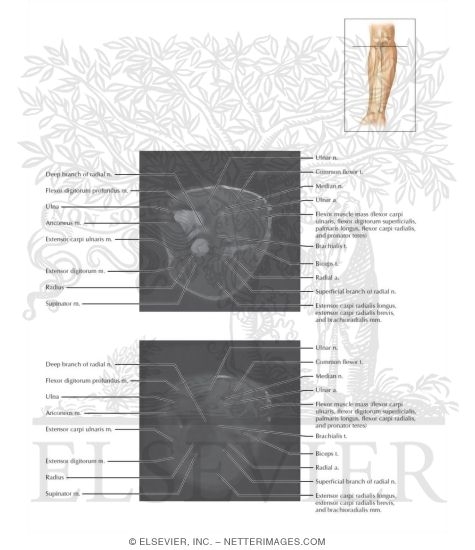 Cross Section of the Forearm: Axial View
