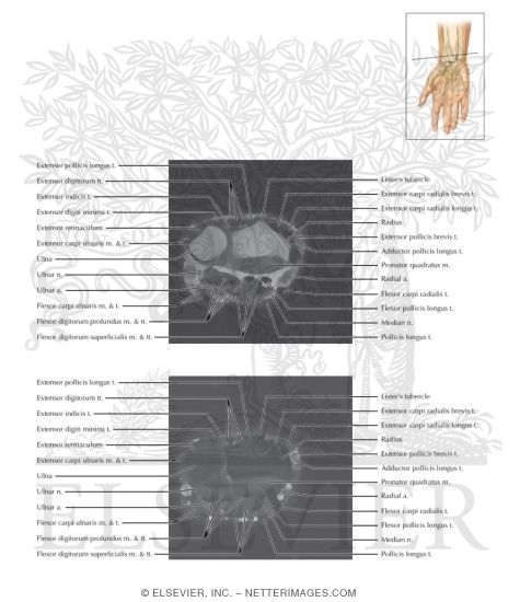 Watermarked preview of labeled image: Cross Section of the Wrist: Axial View