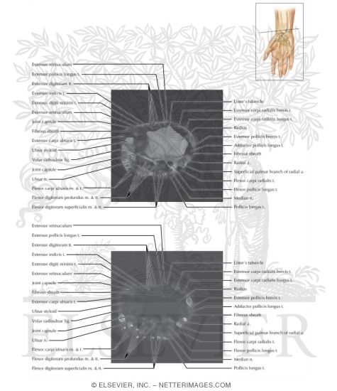 Watermarked preview of labeled image: Cross Section of the Wrist: Axial View