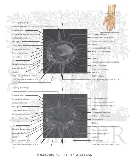 Watermarked preview of labeled image: Cross Section of the Wrist: Axial View
