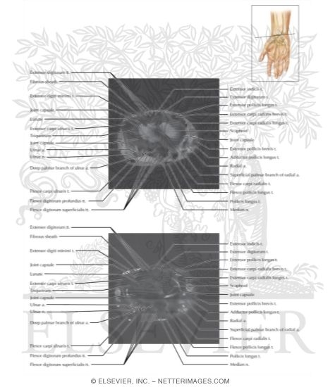Watermarked preview of labeled image: Cross Section of the Wrist: Axial View