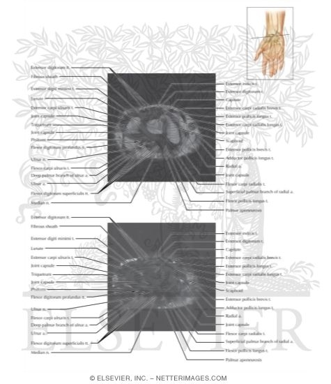 Watermarked preview of labeled image: Cross Section of the Wrist: Axial View