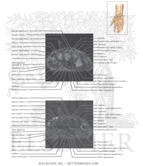 Watermarked preview of labeled image: Cross Section of the Wrist: Axial View