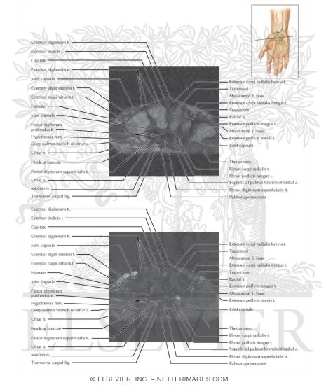 Watermarked preview of labeled image: Cross Section of the Wrist: Axial View