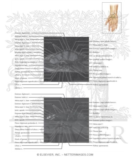 Watermarked preview of labeled image: Cross Section of the Wrist: Axial View