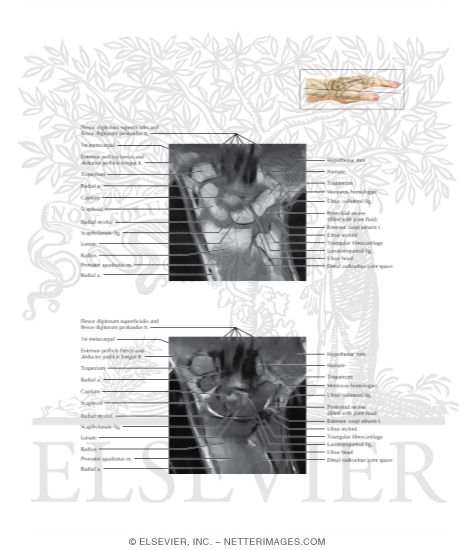 Watermarked preview of labeled image: Cross Section of the Wrist: Coronal View