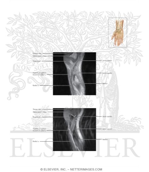 Cross Section of the Wrist: Sagittal View
