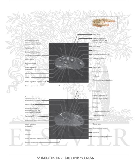Watermarked preview of labeled image: Cross Section of the Hand: Axial View