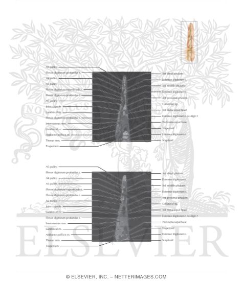Watermarked preview of labeled image: Cross Section of the Hand and Finger: Sagittal View