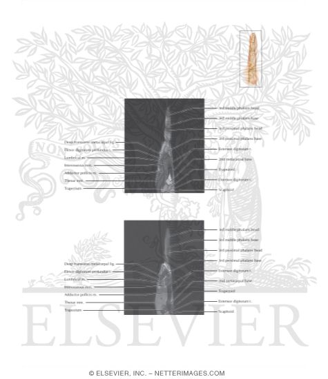 Watermarked preview of labeled image: Cross Section of the Hand and Finger: Sagittal View