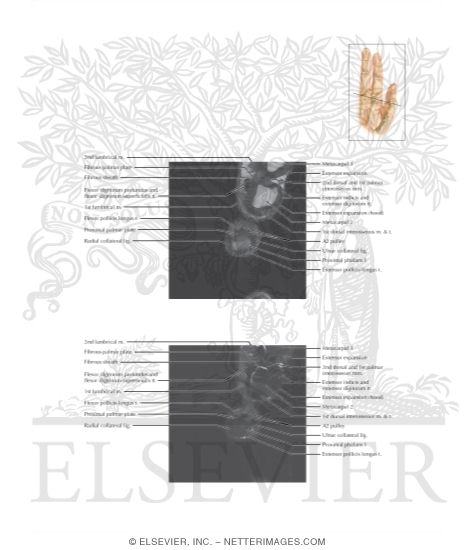 Watermarked preview of labeled image: Cross Section of the Thumb: Axial View