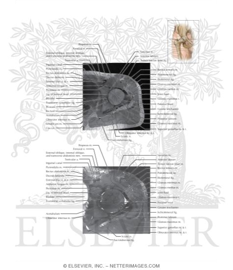 Watermarked preview of labeled image: Cross Section of the Hip: Axial View