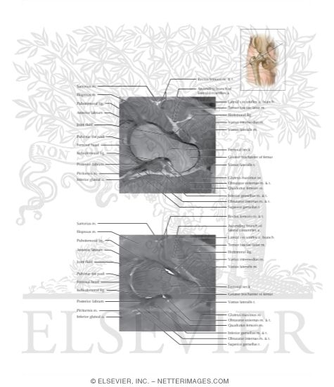Watermarked preview of labeled image: Cross Section of the Hip: Axial Oblique View
