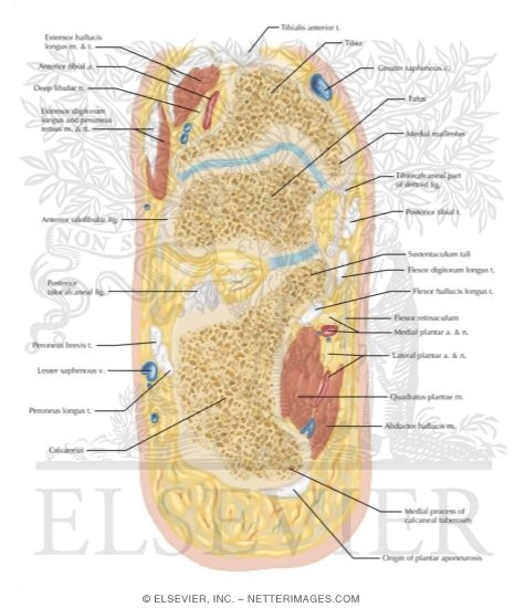 Watermarked preview of labeled image: Cross Section of the Ankle and Foot: Coronal View