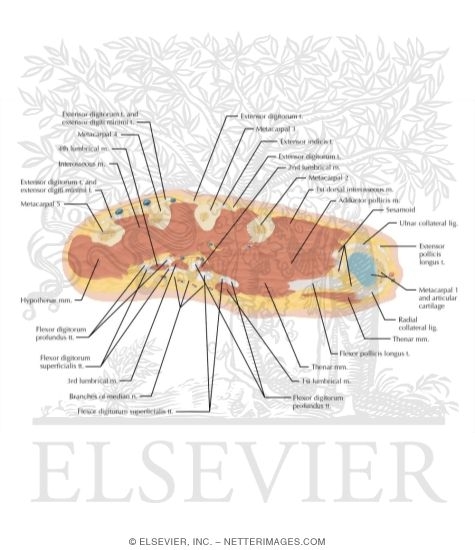 Watermarked preview of labeled image: Cross Section of the Hand: Axial View