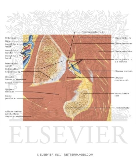 Watermarked preview of labeled image: Cross Section of the Hip: Coronal Oblique View