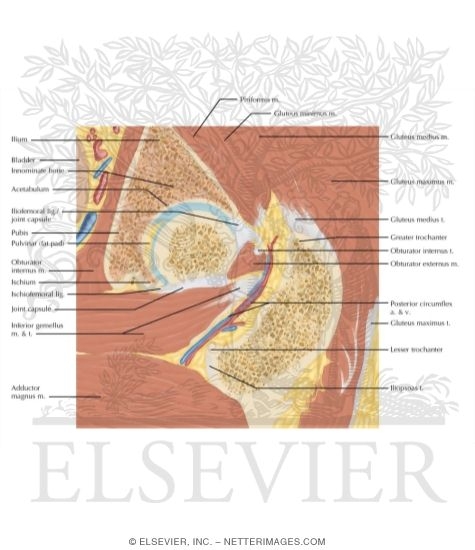 Watermarked preview of labeled image: Cross Section of the Hip: Coronal Oblique View