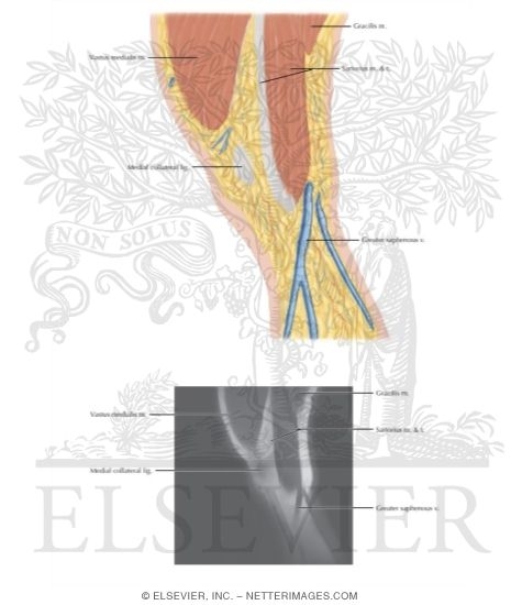 Watermarked preview of labeled image: Cross Section of the Knee: Sagittal View
