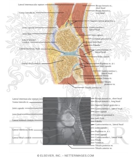 Watermarked preview of labeled image: Cross Section of the Knee: Sagittal View