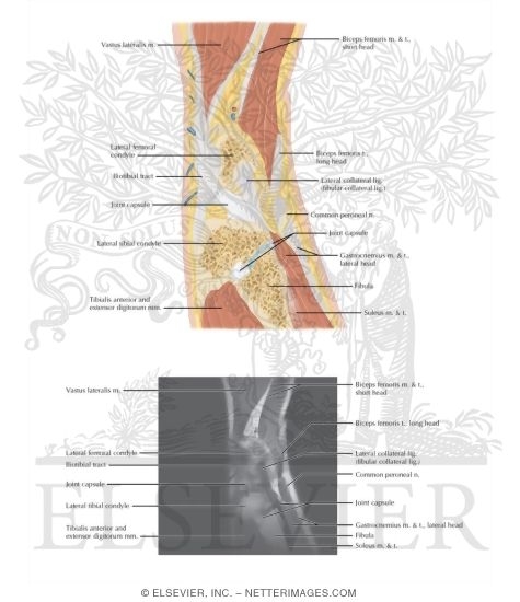 Watermarked preview of labeled image: Cross Section of the Knee: Sagittal View