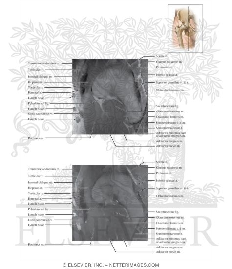 Watermarked preview of labeled image: Cross Section of the Hip: Sagittal View