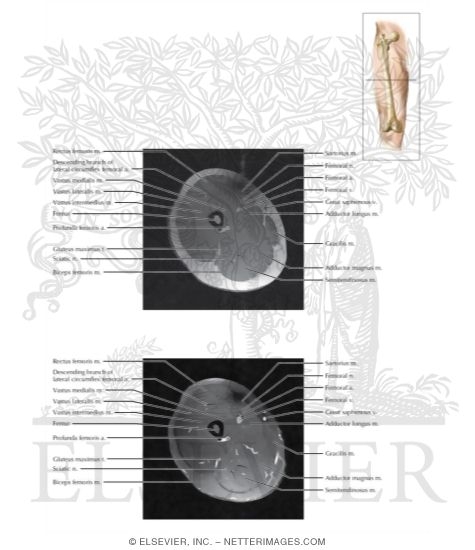 Cross Section of the Thigh: Axial View