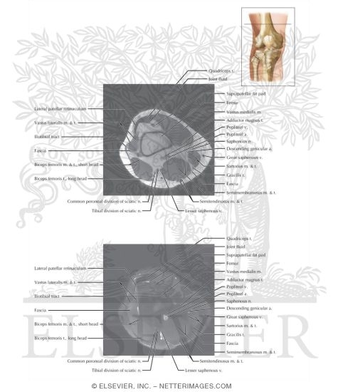 Watermarked preview of labeled image: Cross Section of the Knee: Axial View