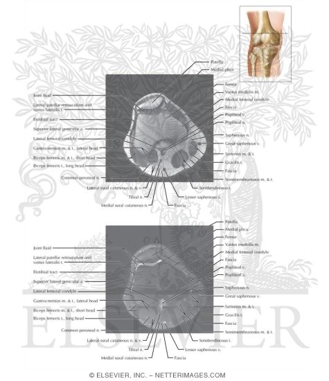Cross Section of the Knee: Axial View
