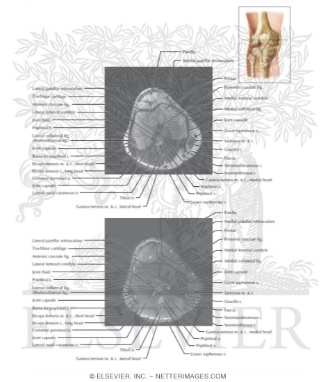 Cross Section of the Knee: Axial View