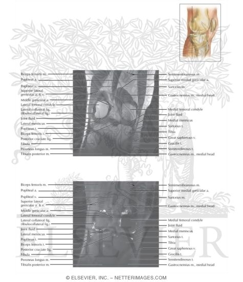 Cross Section of the Knee: Coronal View
