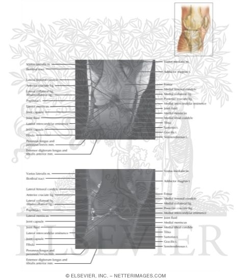 Cross Section of the Knee: Coronal View
