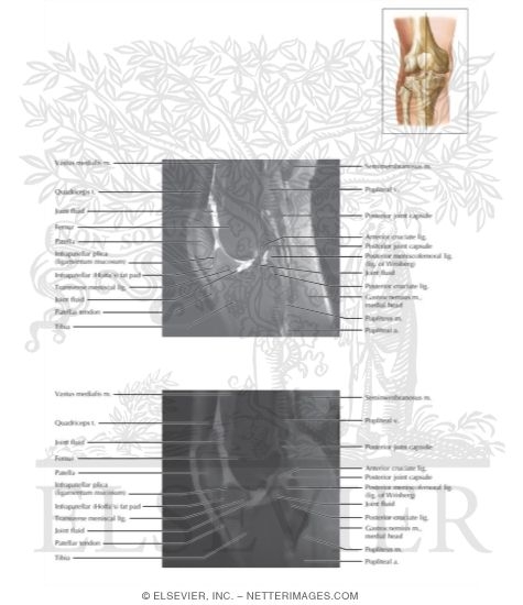 Watermarked preview of labeled image: Cross Section of the Knee: Sagittal View