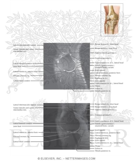 Watermarked preview of labeled image: Cross Section of the Knee: Sagittal View