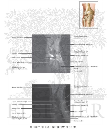 Watermarked preview of labeled image: Cross Section of the Knee: Sagittal View